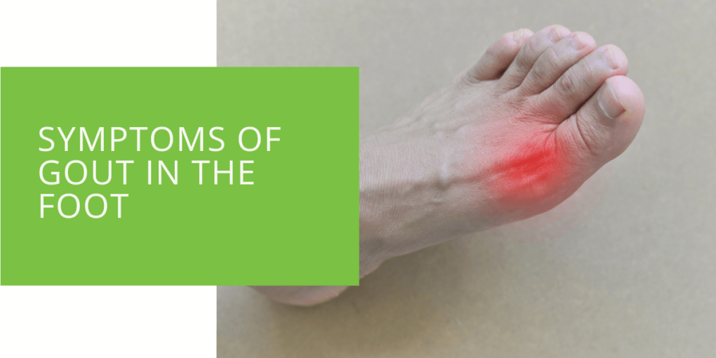 Symptoms of Gout in the Foot