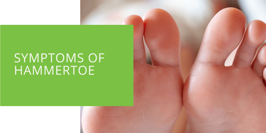 Symptoms of Hammertoe