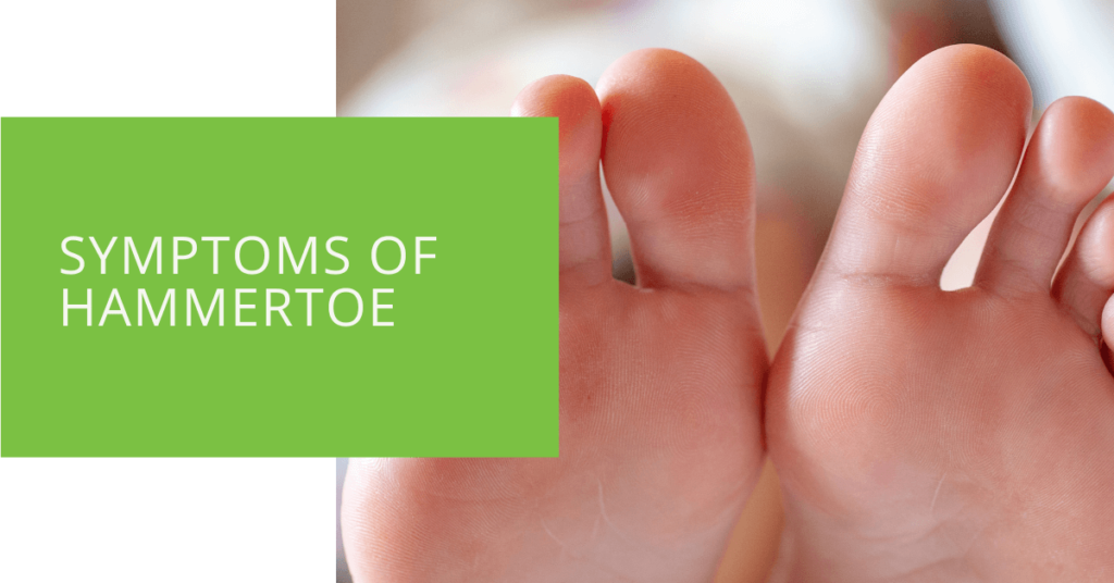 Symptoms of Hammertoe