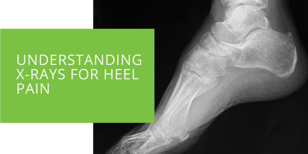 Understanding X-rays for Heel Pain