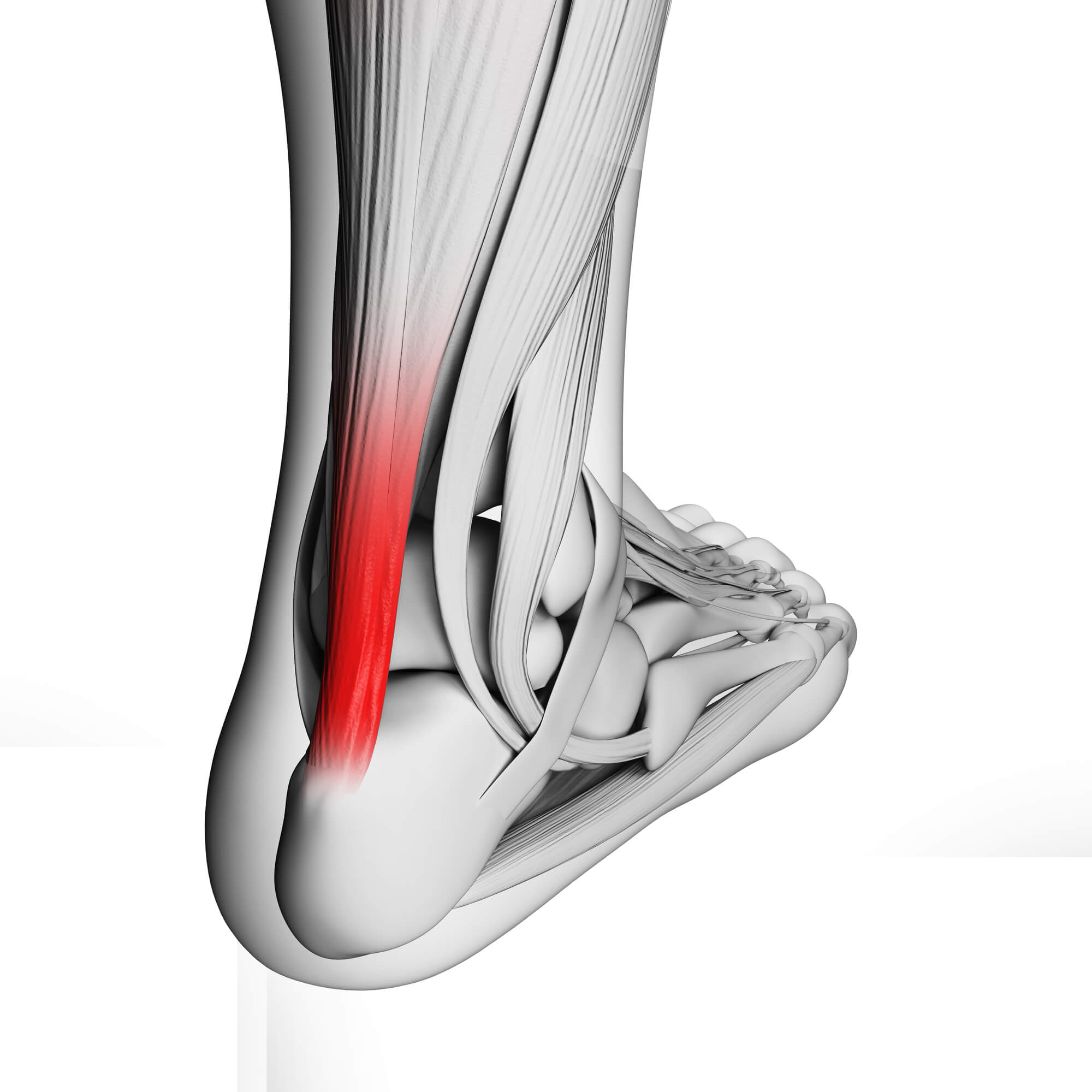 Achilles Tendon