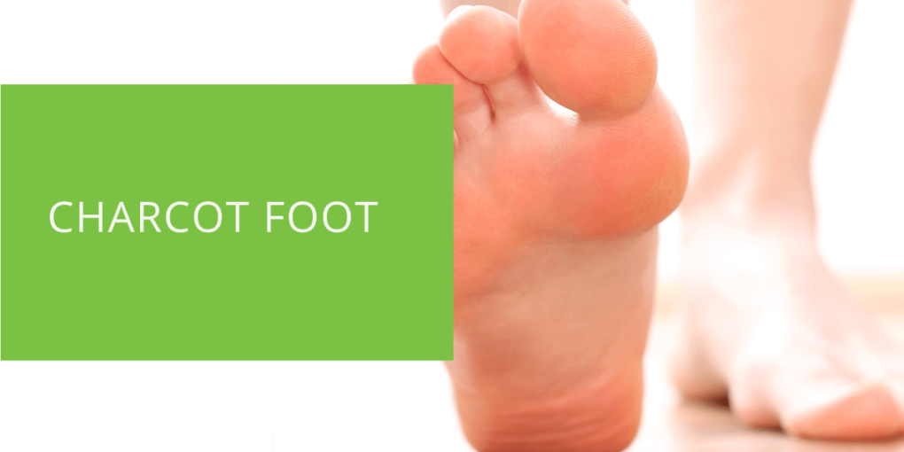 Charcot Foot