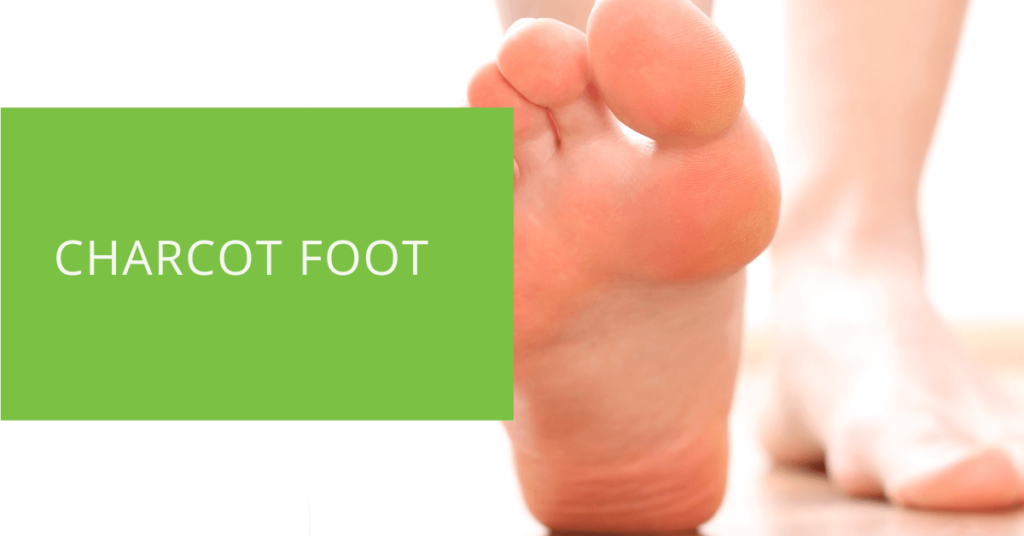 Charcot Foot