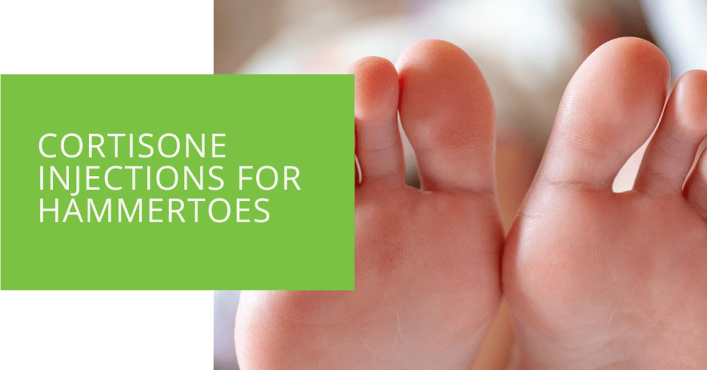 Cortisone Injections for Hammertoes