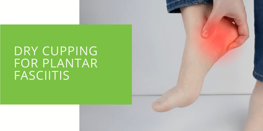 Dry Cupping for Plantar Fasciitis