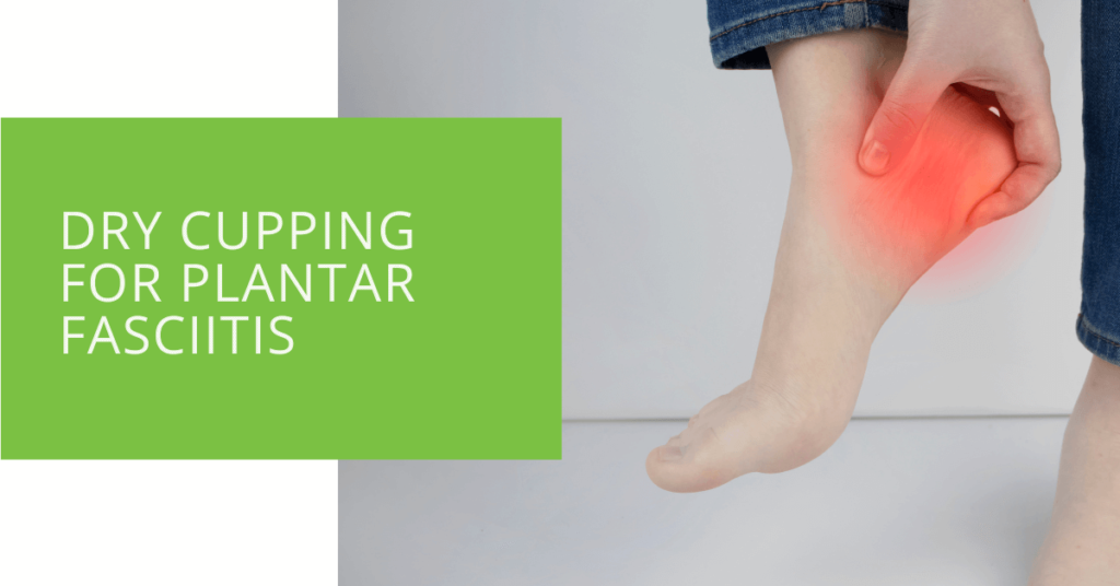 Dry Cupping for Plantar Fasciitis