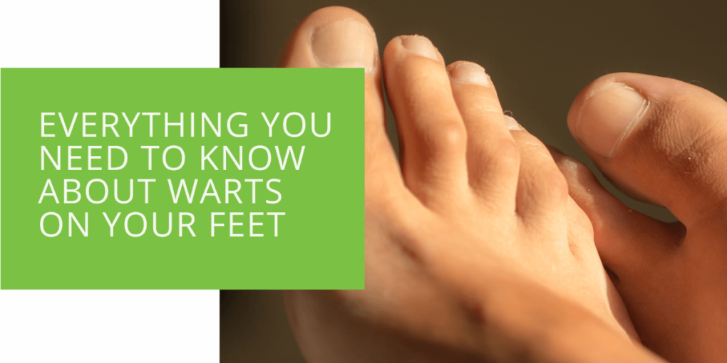Everything You Need to Know About Warts on Your Feet