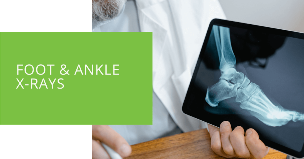 Foot & Ankle X-Rays