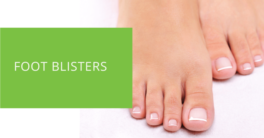 Foot Blisters