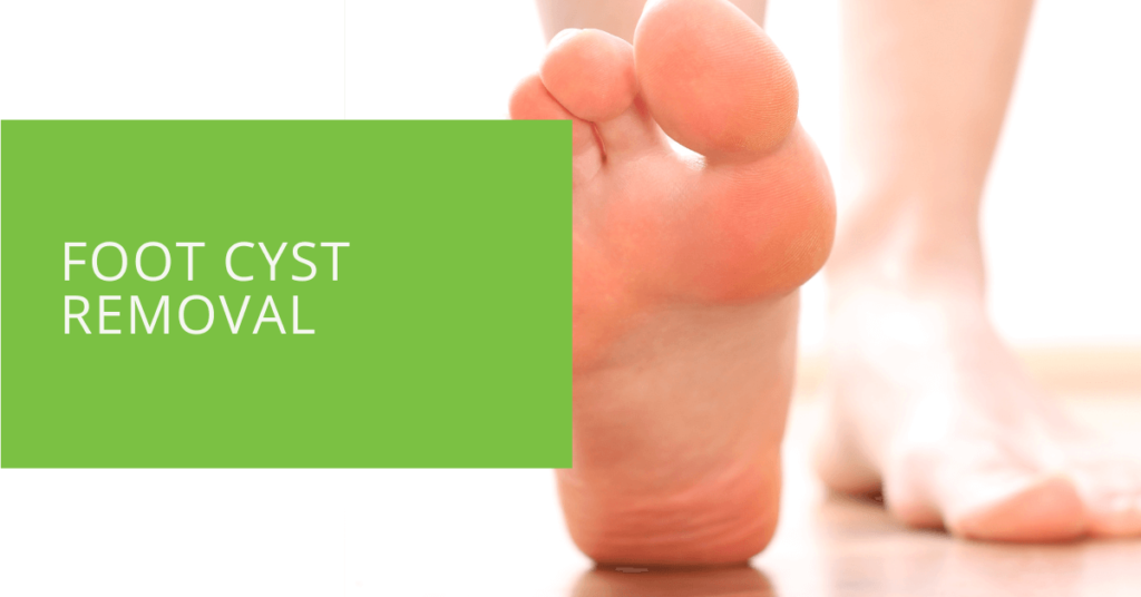 Foot Cyst Removal