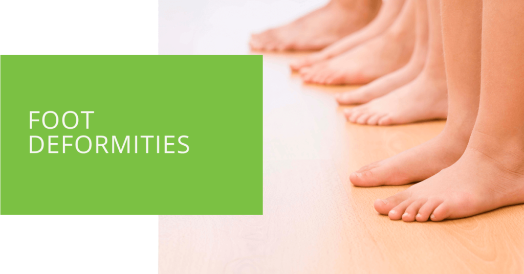 Foot Deformities