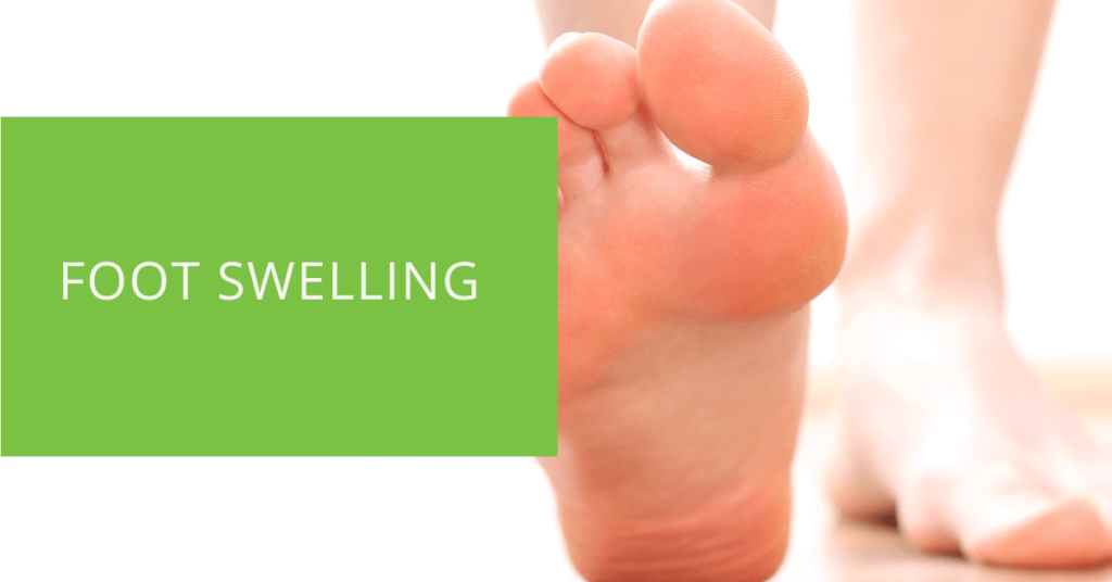 Foot Swelling