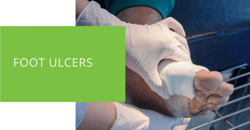 Foot Ulcers