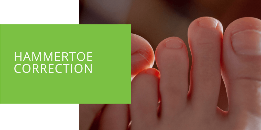 Hammertoe Correction