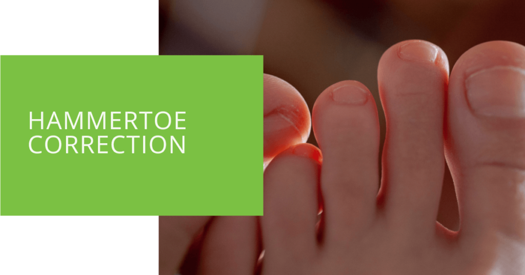Hammertoe Correction