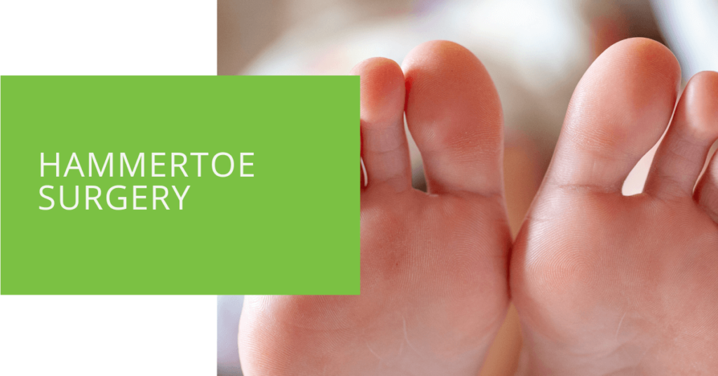 Hammertoe Surgery
