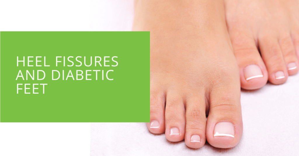 Heel Fissures and Diabetic Feet