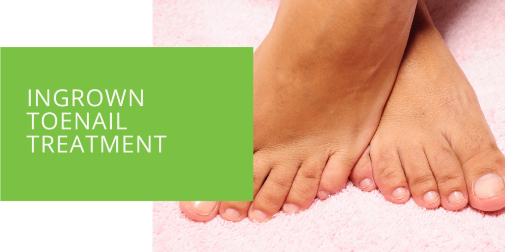 Ingrown Toenail Treatment