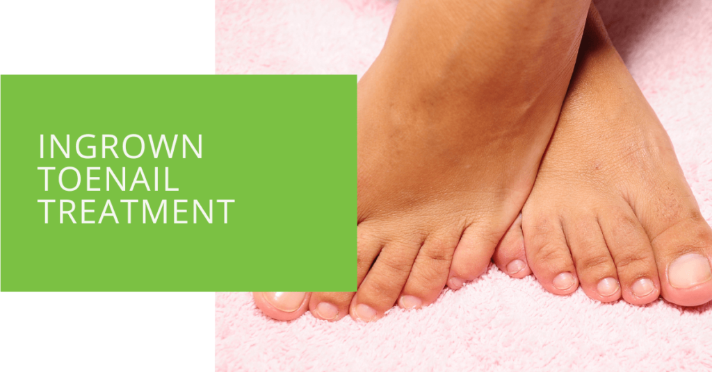 Ingrown Toenail Treatment