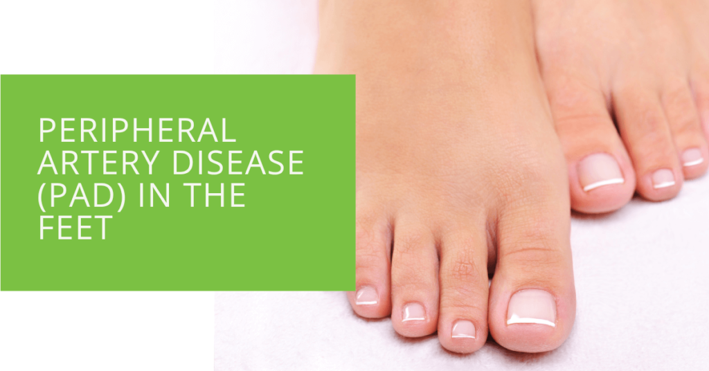 Peripheral Artery Disease (PAD) in the Feet