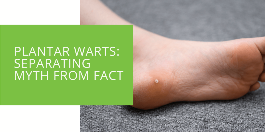 Plantar Warts Separating Myth from Fact