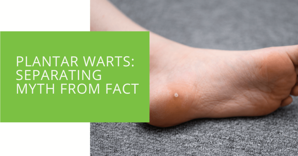 Plantar Warts Separating Myth from Fact