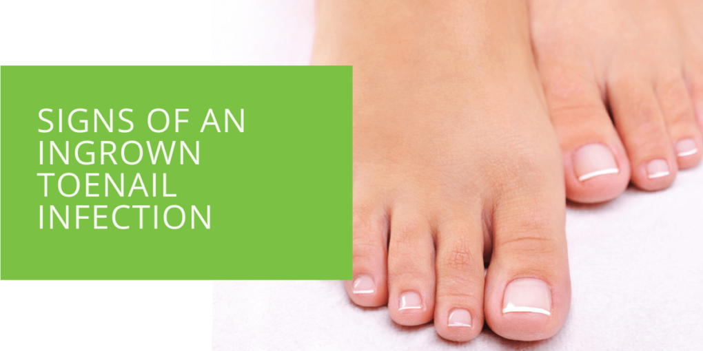 Signs of an Ingrown Toenail Infection