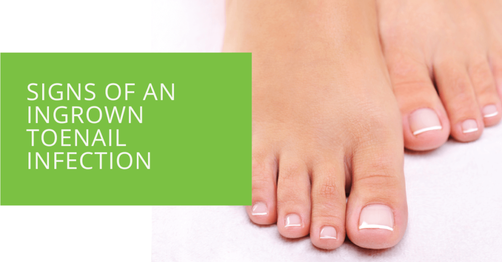 Signs of an Ingrown Toenail Infection