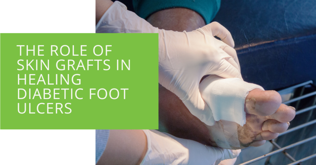 The Role of Skin Grafts in Healing Diabetic Foot Ulcers