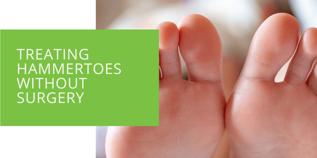 Treating Hammertoes Without Surgery
