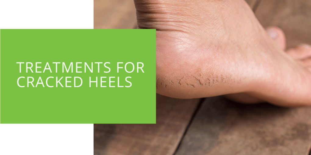 Treatments for Cracked Heels