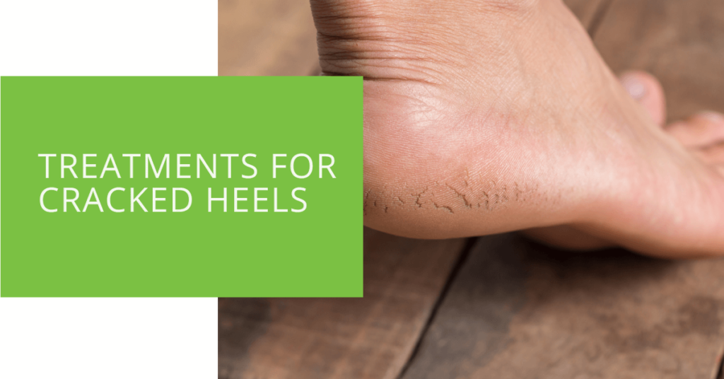 Treatments for Cracked Heels
