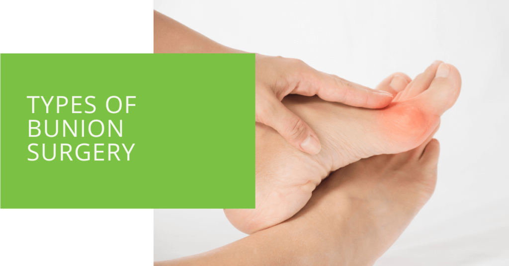 Types of Bunion Surgery