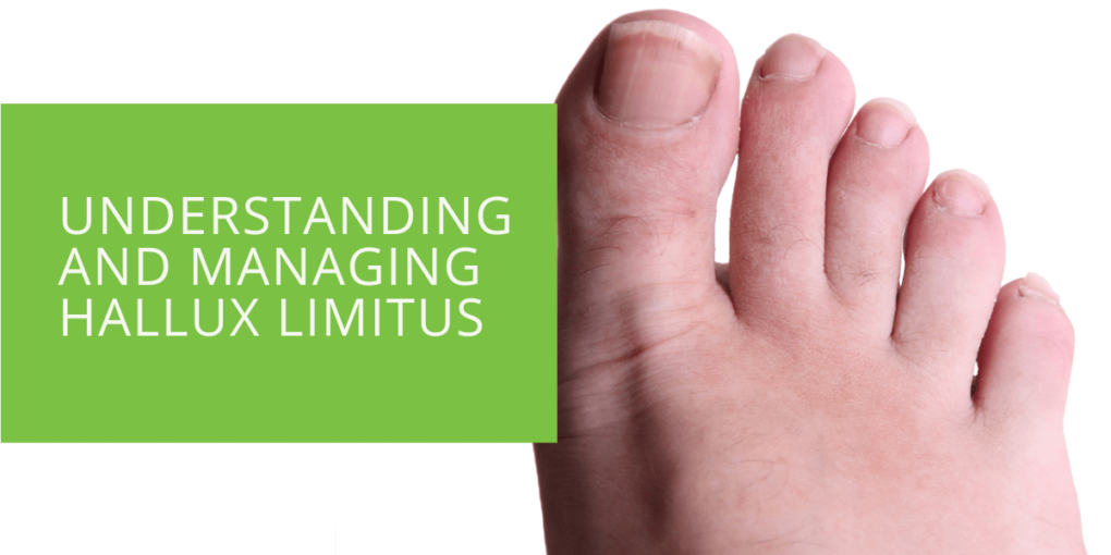 Understanding and Managing Hallux Limitus