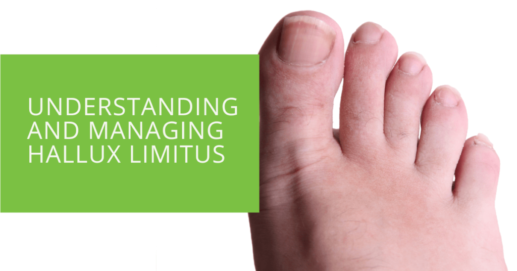 Understanding and Managing Hallux Limitus