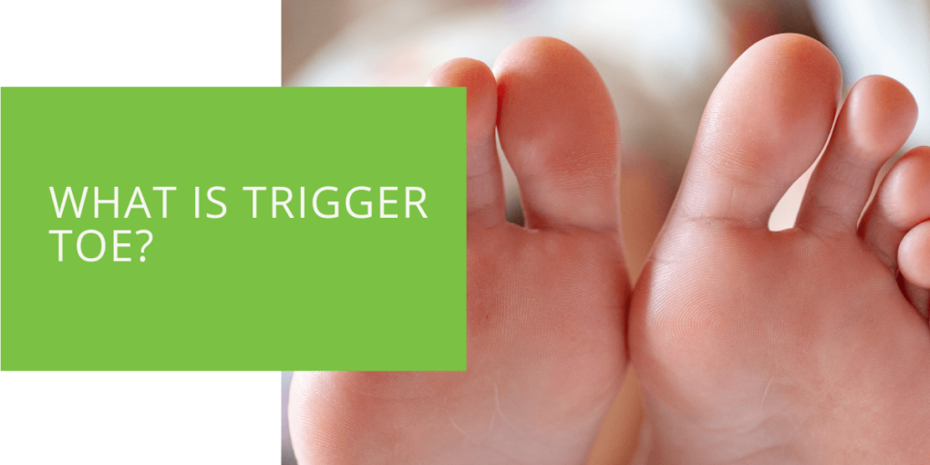 What is Trigger Toe