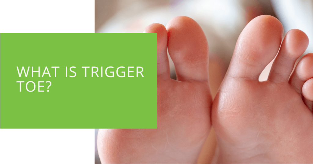 What is Trigger Toe