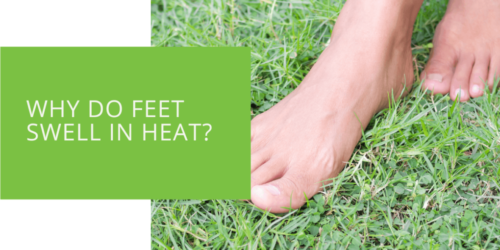 Why Do Feet Swell in Heat
