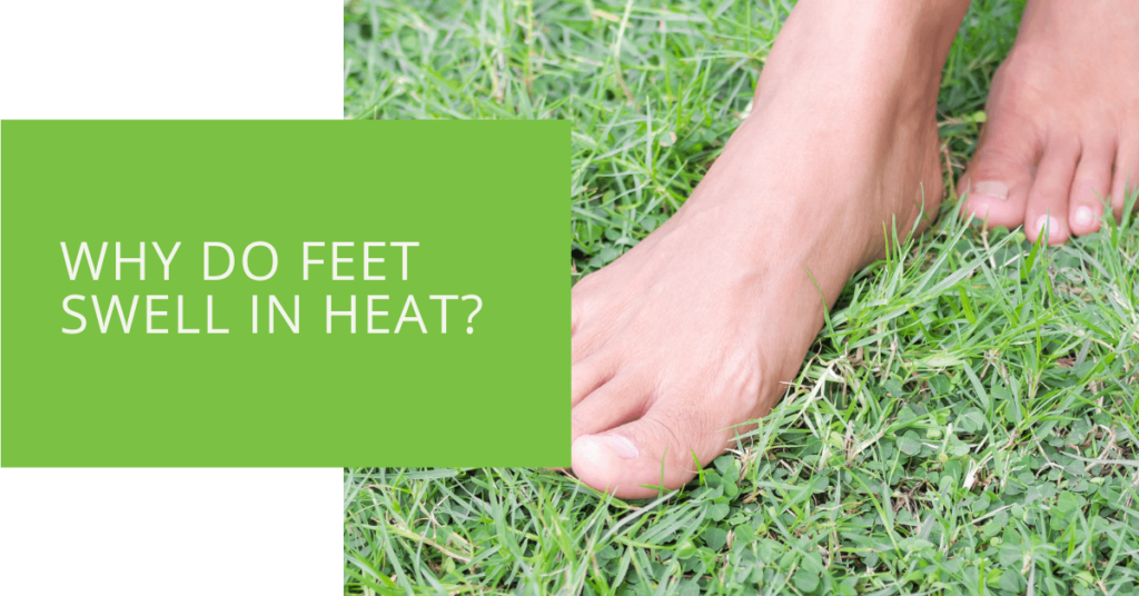 Why Do Feet Swell in Heat
