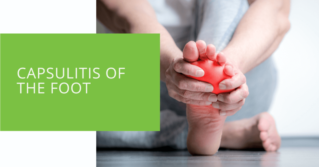 Capsulitis of the Foot