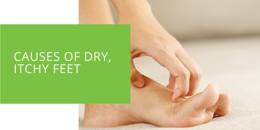 Causes of Dry, Itchy Feet