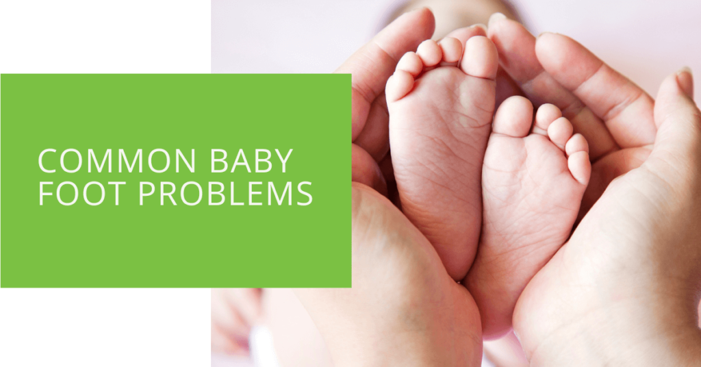 Common Baby Foot Problems