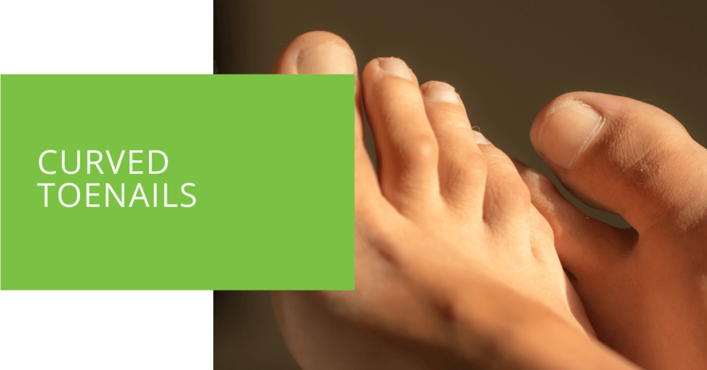 Curved Toenails