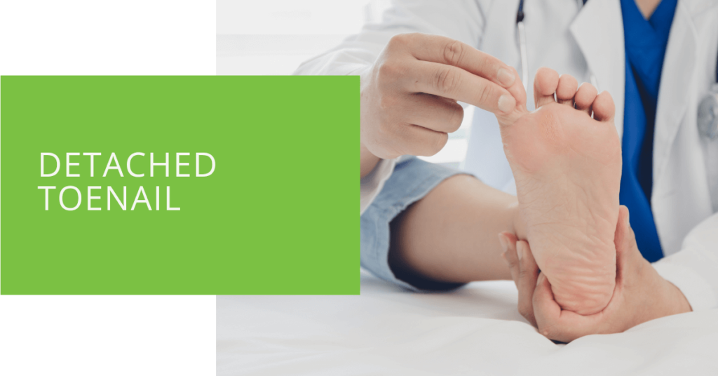 Detached Toenail
