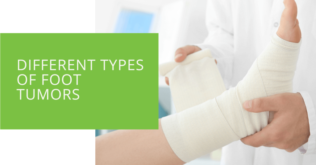 Different Types of Foot Tumors