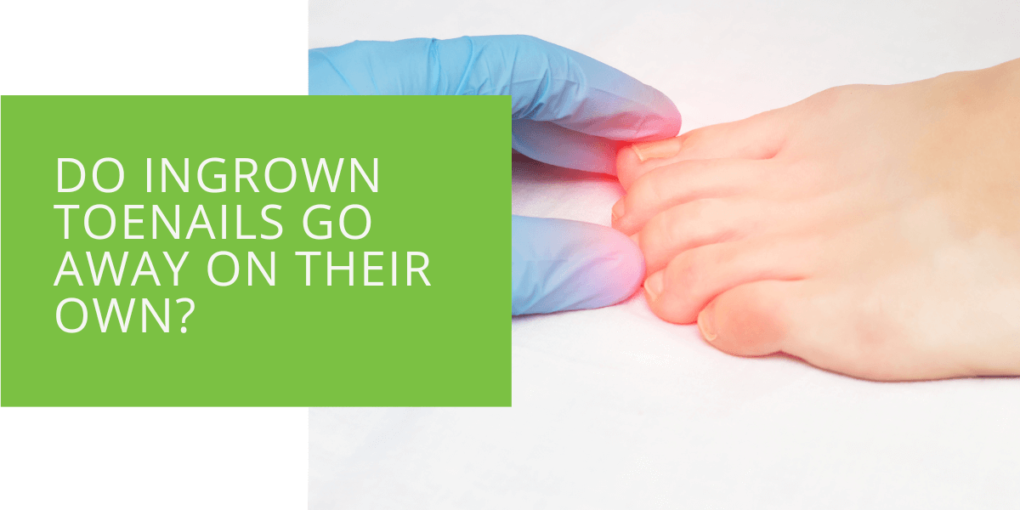 Do Ingrown Toenails Go Away on Their Own