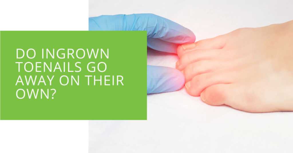 Do Ingrown Toenails Go Away on Their Own