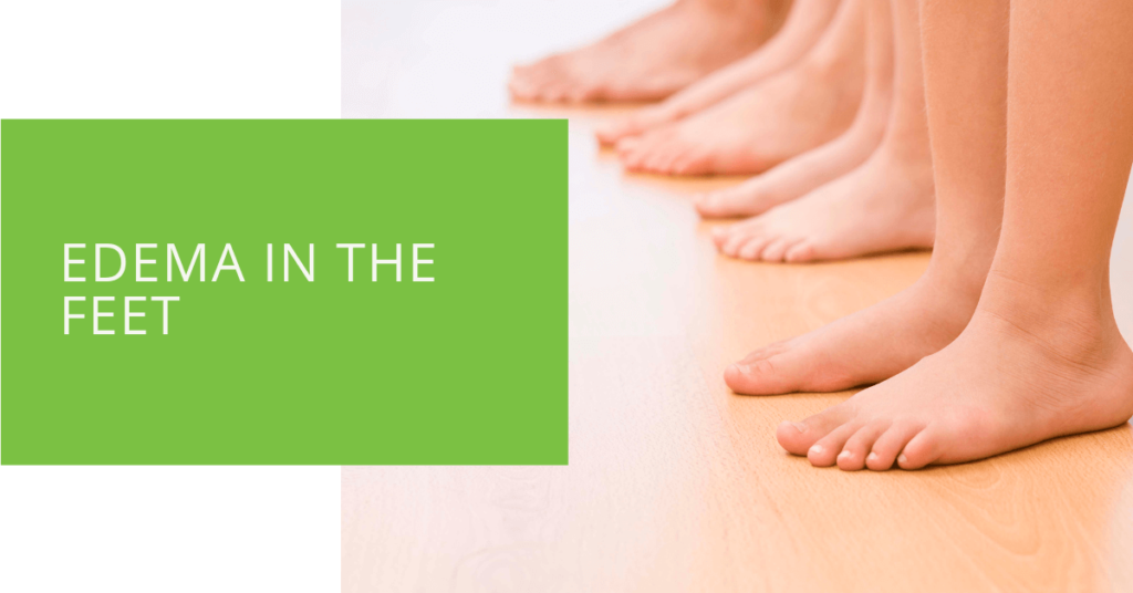 Edema in the Feet