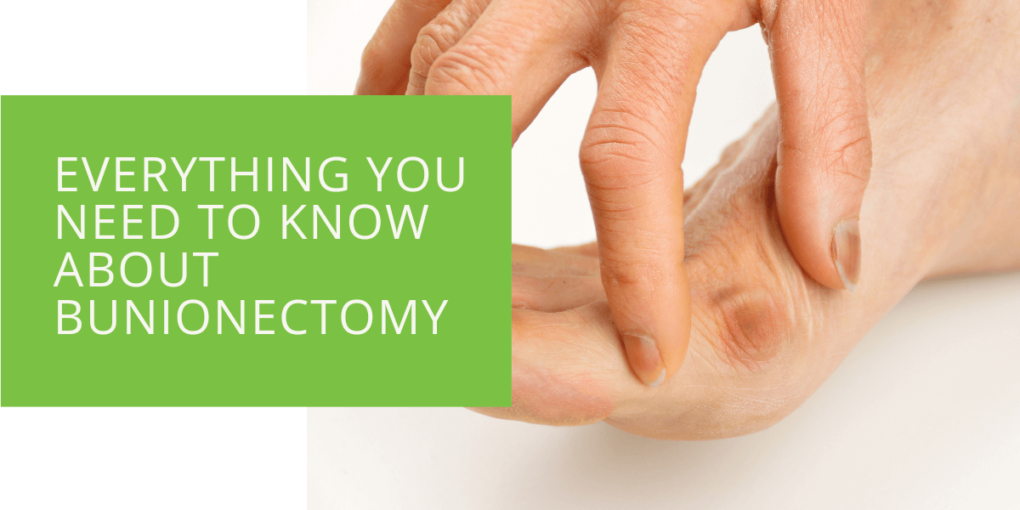 Everything You Need to Know About Bunionectomy
