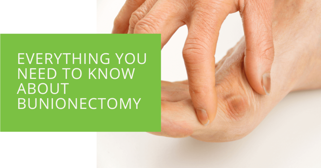 Everything You Need to Know About Bunionectomy